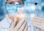 Dentist model 1 Wafer Sheet - Lumea